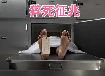 猝死的人都有哪些规律征兆？